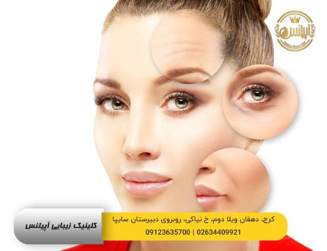 بوتاکس در کرج
