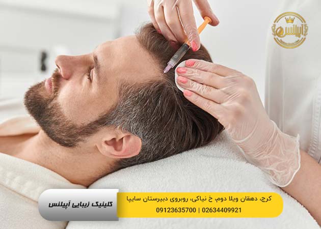 مزوتراپی در کرج
