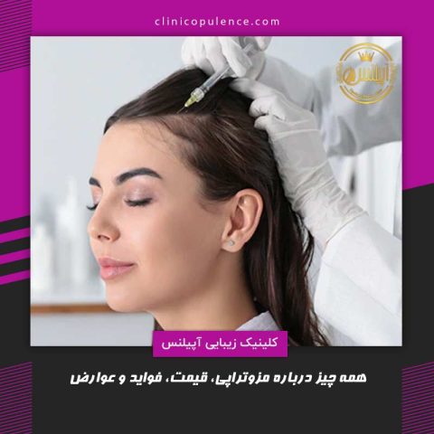 مزوتراپی کرج موی سر
