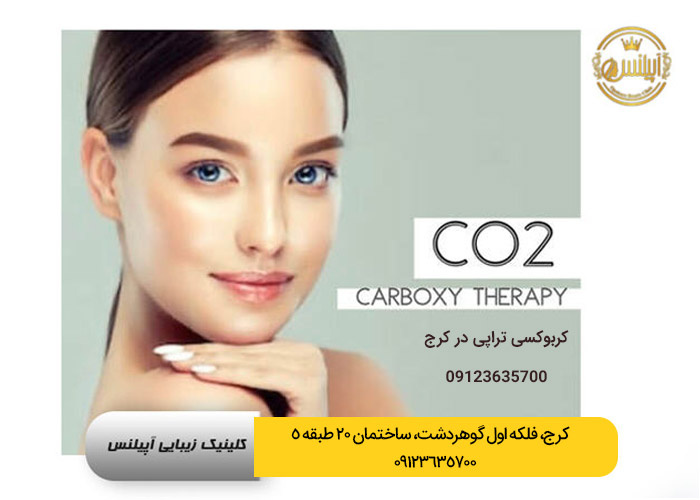 کربوکسی تراپی در کرج