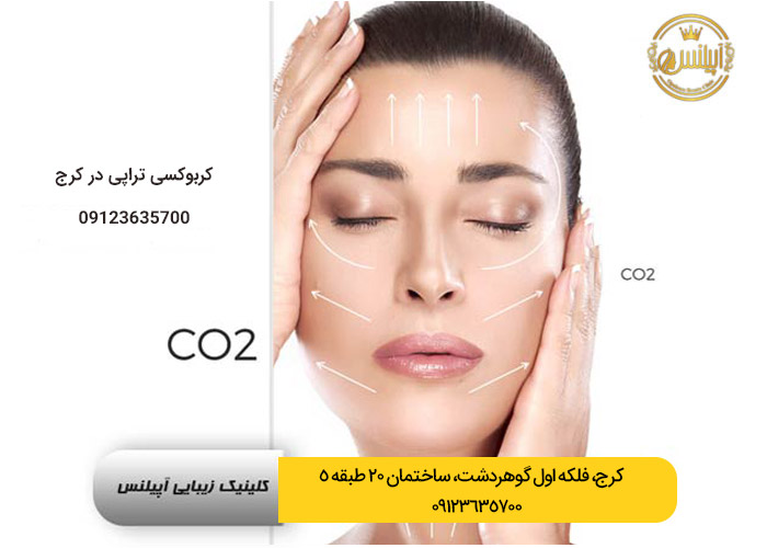 کربوکس تراپی کرج تهران