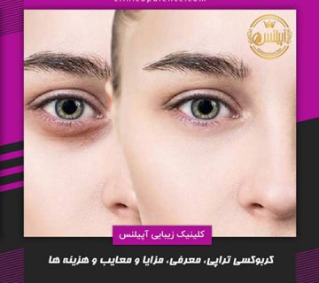 کربوکسی تراپی در کرج