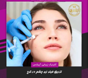 فیلر زیر چشم