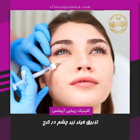 فیلر زیر چشم