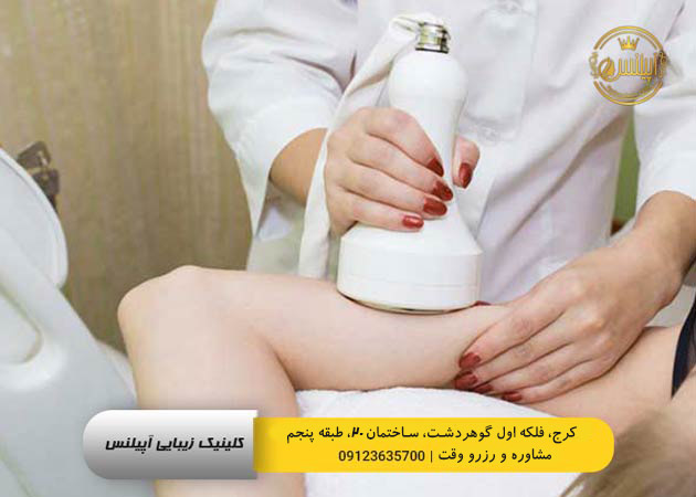 بهترین روش های لاغری در کرج در کلینیک آپیلنس