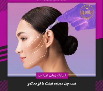 لیفت با نخ در کرج صورت