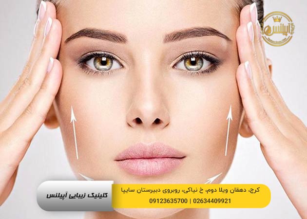 لیفت با نخ در کرج