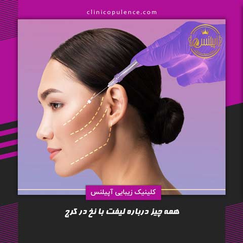 لیفت با نخ در کرج صورت
