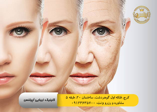 لیفت با نخ در گوهردشت کرج