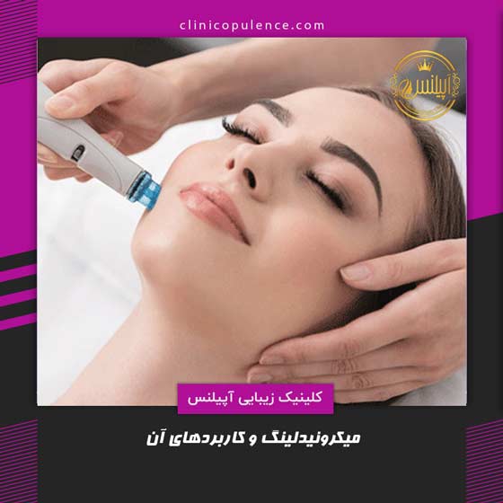 میکرونیدلینگ کرج
