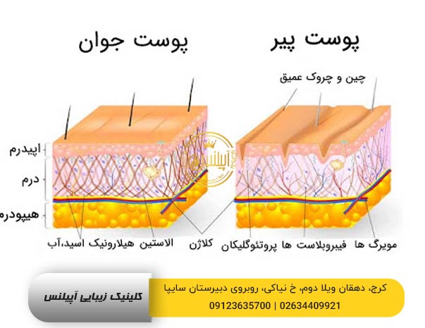 هایفو تراپی در کرج