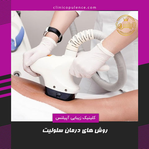 رفع سلولیت کرج