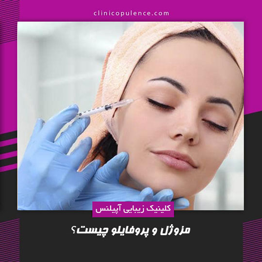 مزوژل کرج پروفایلو