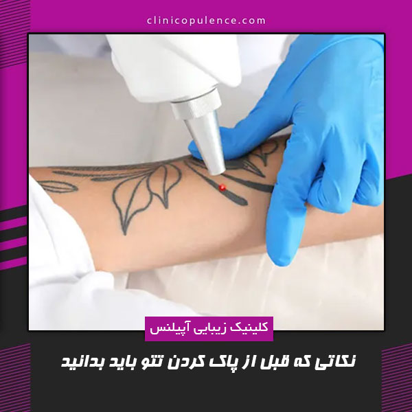 تتو ریموال کرج
