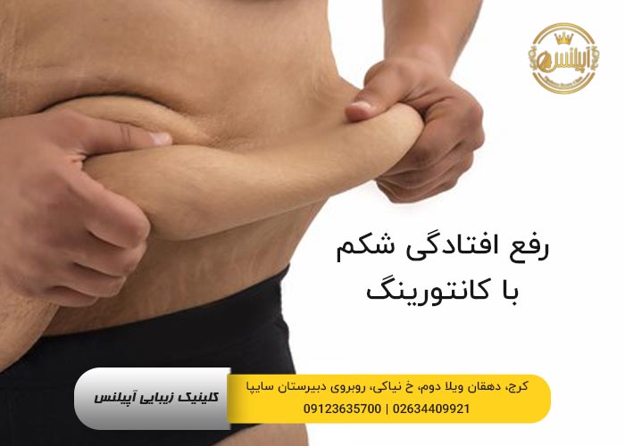 رفع افتادگی شکم با کانتورینگ در کرج