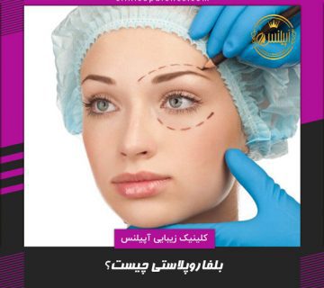 بلفاروپلاستی در کرج