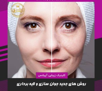 جوانسازی کرج