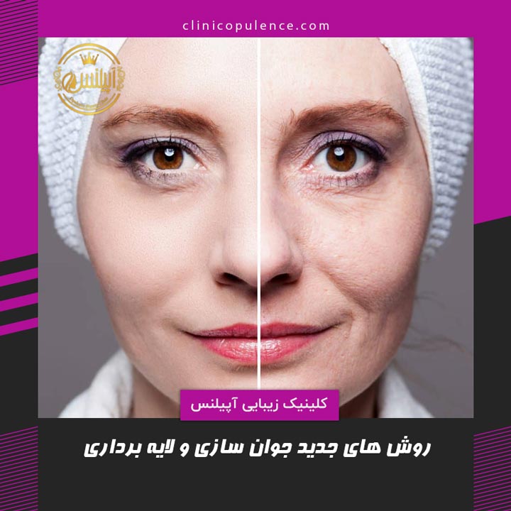 جوانسازی کرج