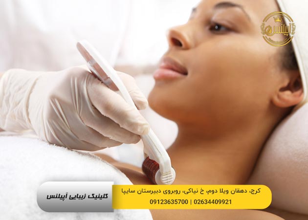 غلتک میکرونیدلینگ
