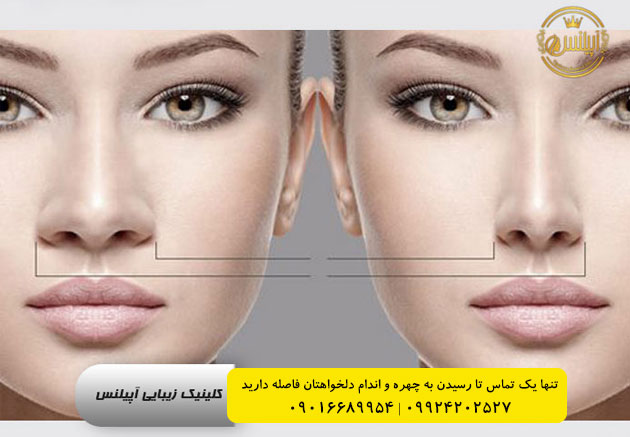 آنزیم زدن برای کوچیک کردن بینی در کرج