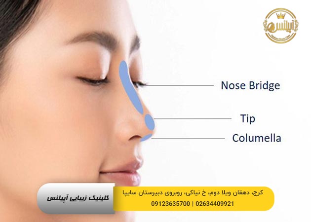 فیلر بینی در کرح