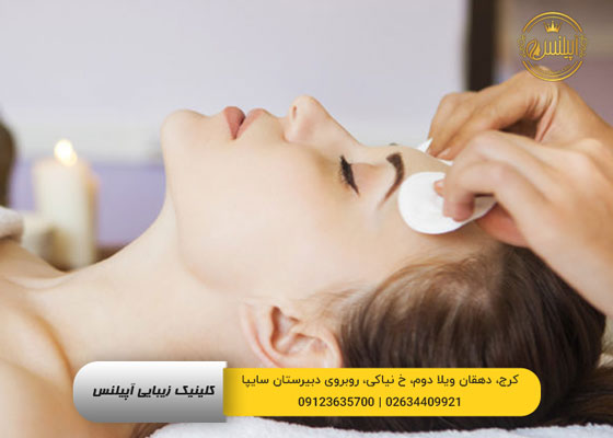لایه برداری با فیشیال در کرج