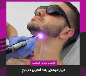 لیزر بدن آقایان در کرج