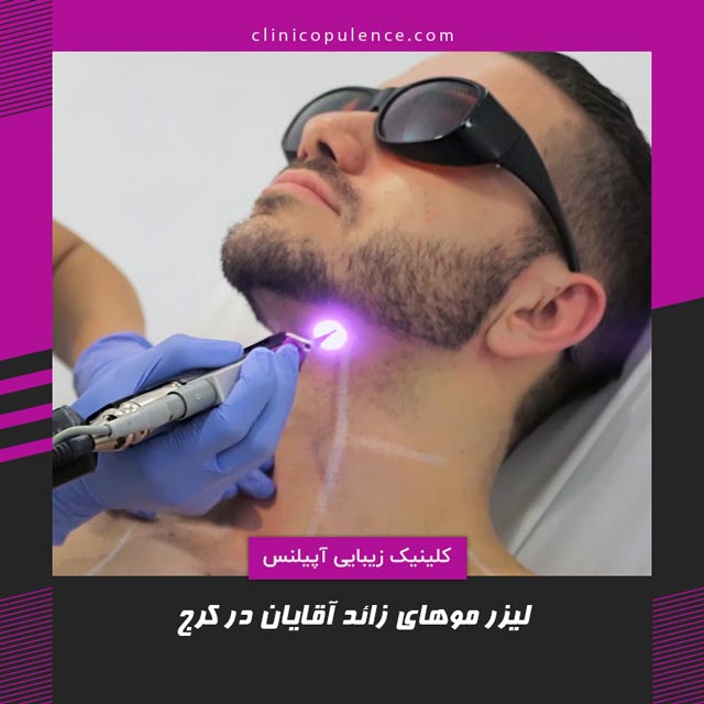 لیزر بدن آقایان در کرج