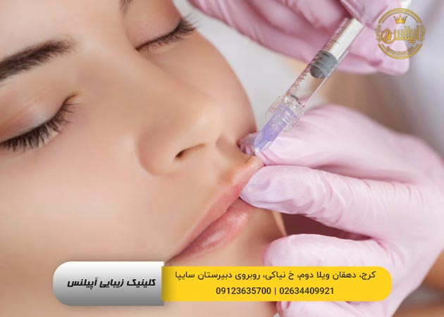 فیلر لب ژل لب روسی 