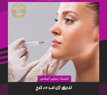 تزریق ژل لب کرج