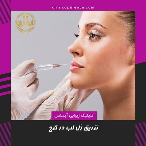 تزریق ژل لب کرج