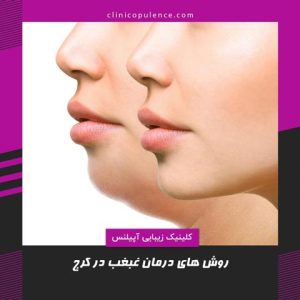 رفع-غبغب-در-کرج درمان دائمی غبغب