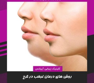 درمان دائمی غبغب