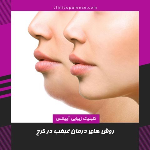 درمان دائمی غبغب
