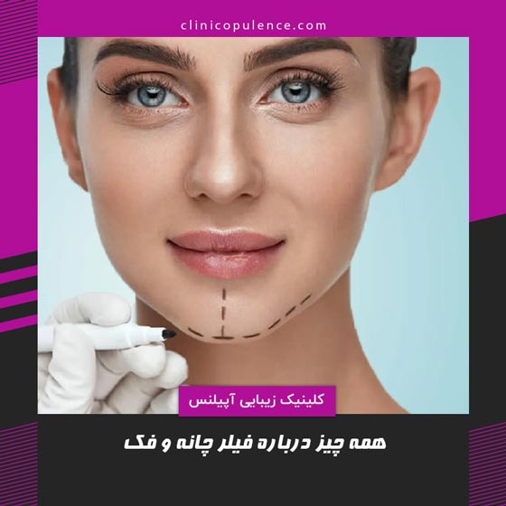 فیلر چانه و فک تزریق پرکننده در کرج
