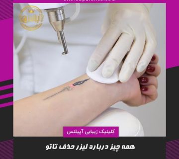 لیزر حذف تاتو کرج