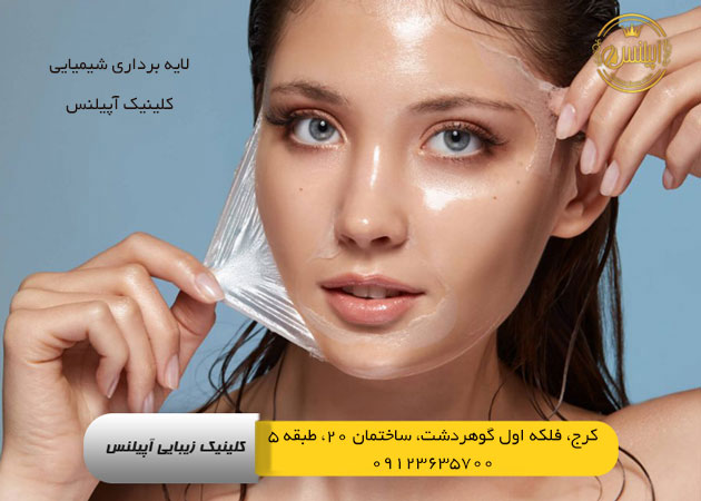 پیلینیگ صورت در کرج