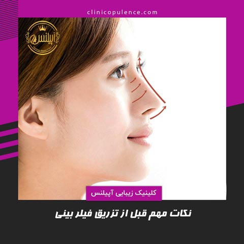 تزریق فیلر بینی