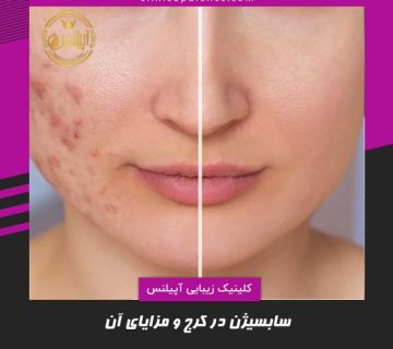 سابسیژن کرج
