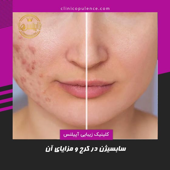 سابسیژن کرج