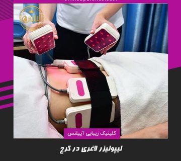 لیپولیزر لاغری در کرج