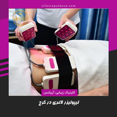 لیپولیزر لاغری در کرج