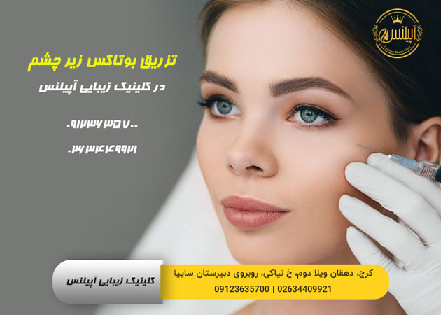 بوتاکس زیر چشم کرج
