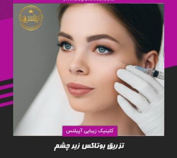 تزریق بوتاکس زیر چشم در کرج