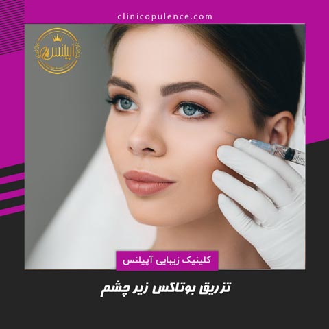 تزریق بوتاکس زیر چشم در کرج