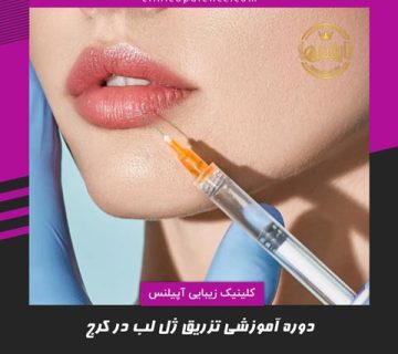 تزریق ژل لب در کرج