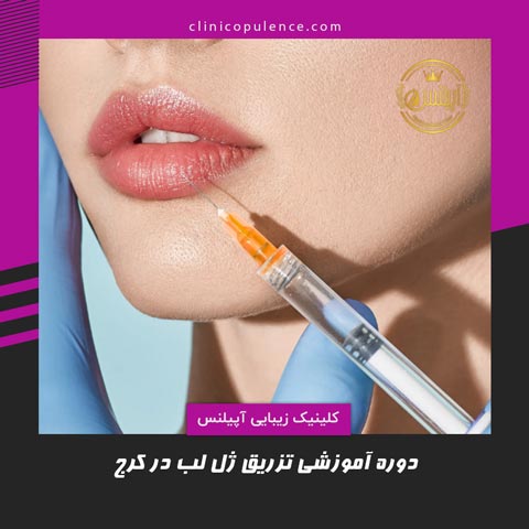 تزریق ژل لب در کرج