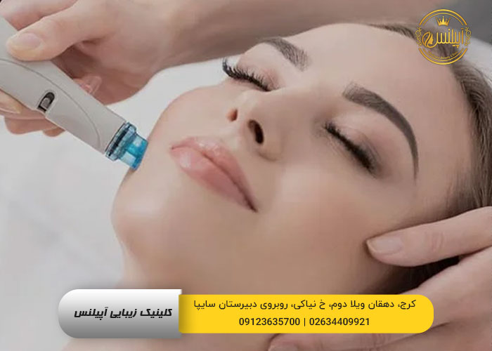 هیدرودرم در کرج