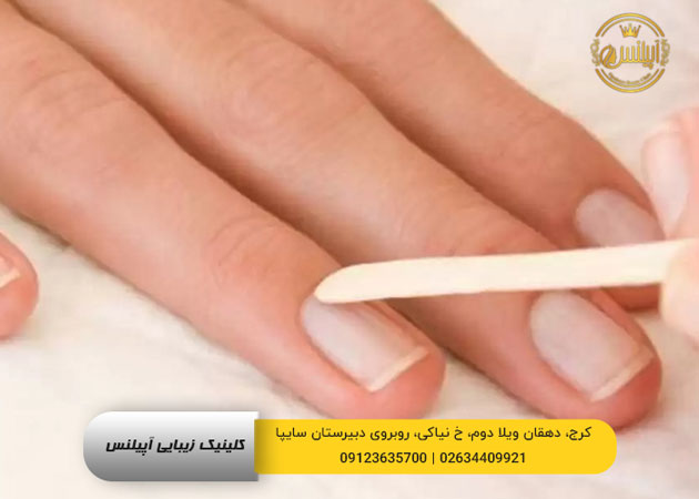 سوهان زدن برای تقویت ناخن