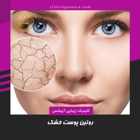 روتین پوست خشک